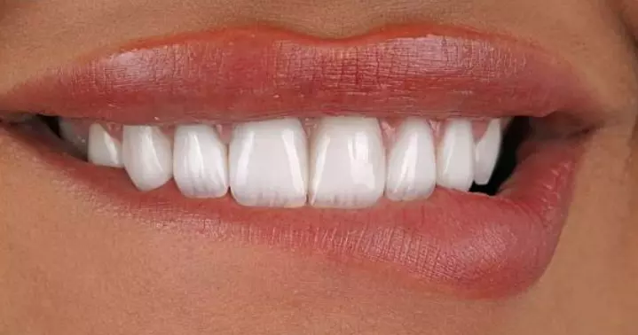 ЕстетскастоматологијаТетово