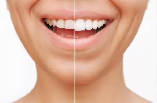 КорекцијаназабитеВелес4