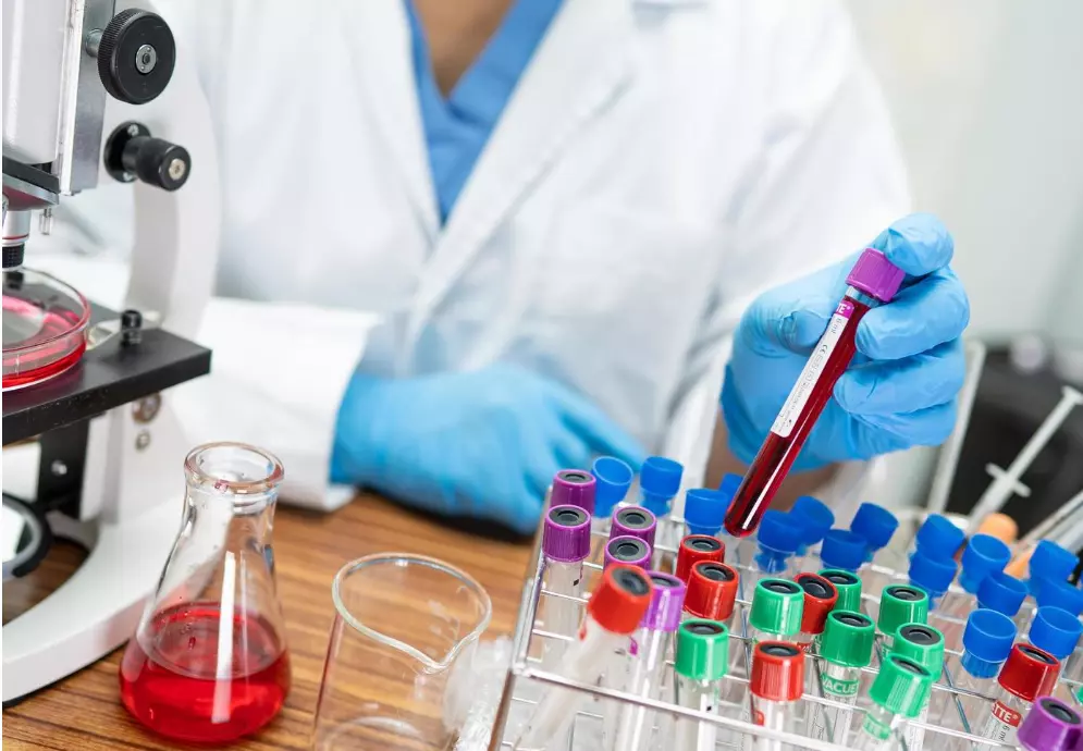 ЛекарсолабораторискитестовиРадовишB