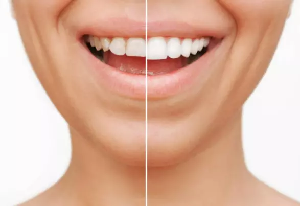 НајдобратастоматолошкаординацијаСкопје