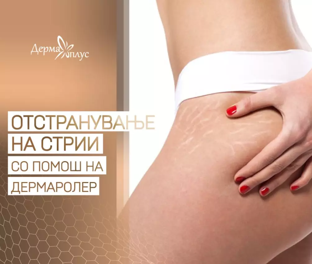 ТретманзаотстранувањестрииСкопјеB