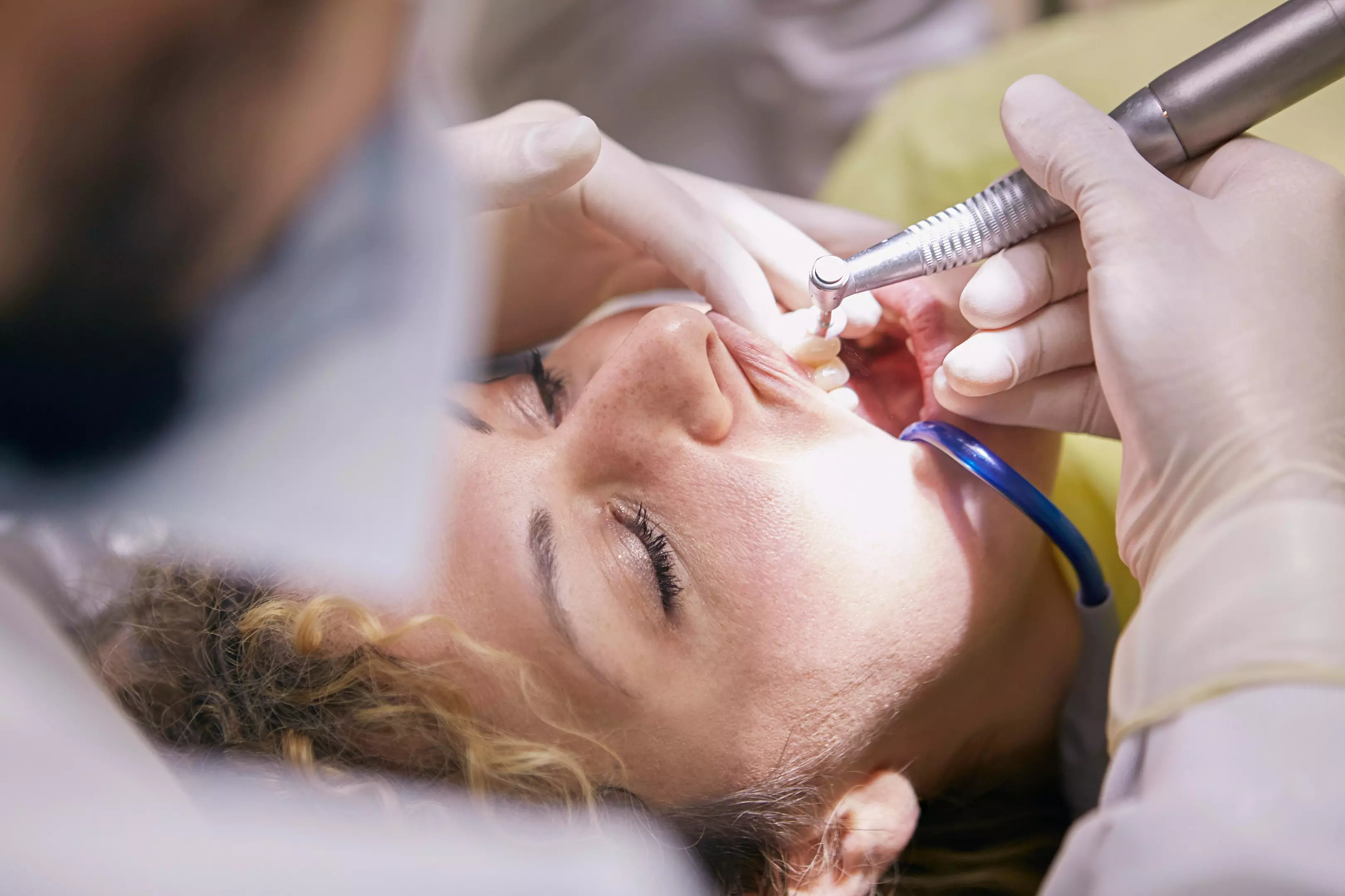 Dentist_and_dental_cleaning_Skopje
