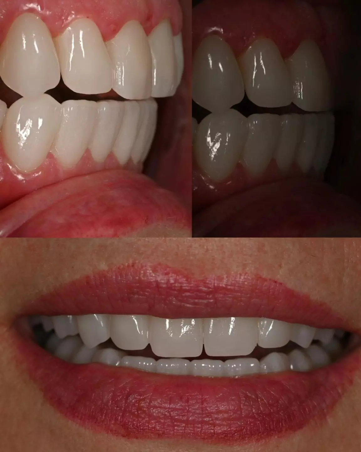 DentistimëimirënëMaqedoni