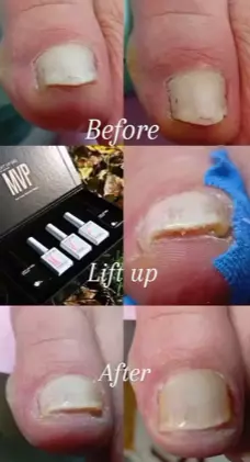 NajdobarmanikirvoTetovoСС1