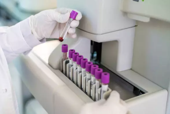 labaratoriskianaliziskopje1