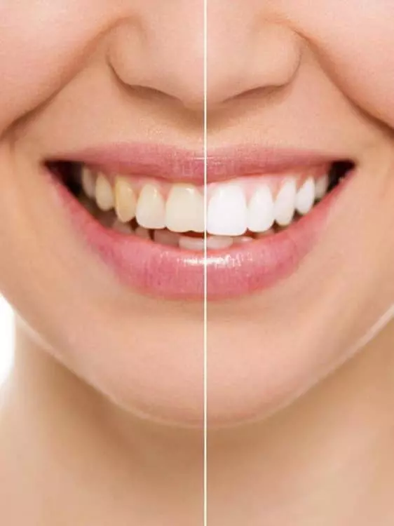 ЕстетскастоматологијасоденталнапраксаКочани ЕстетскастоматологијасоденталнапраксаКочани