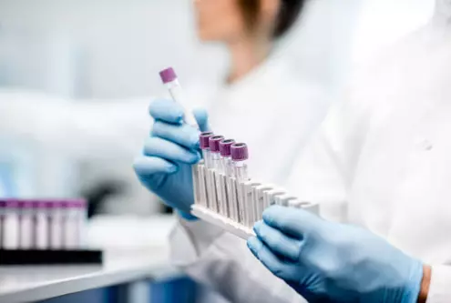 КомплетнабиохемискадијагоностичкалабараторијаМакедонија КомплетнабиохемискадијагоностичкалабараторијаМакедонија