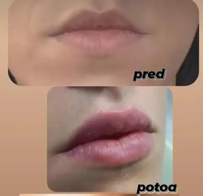 Screenshot 20231214 094352 Instagram.jpg